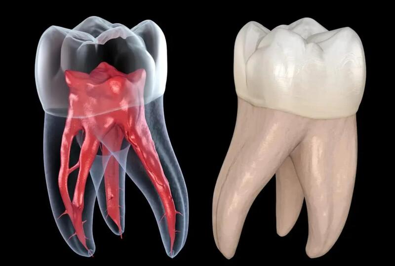 điều trị tủy răng tại hoàn mỹ sài gòn
